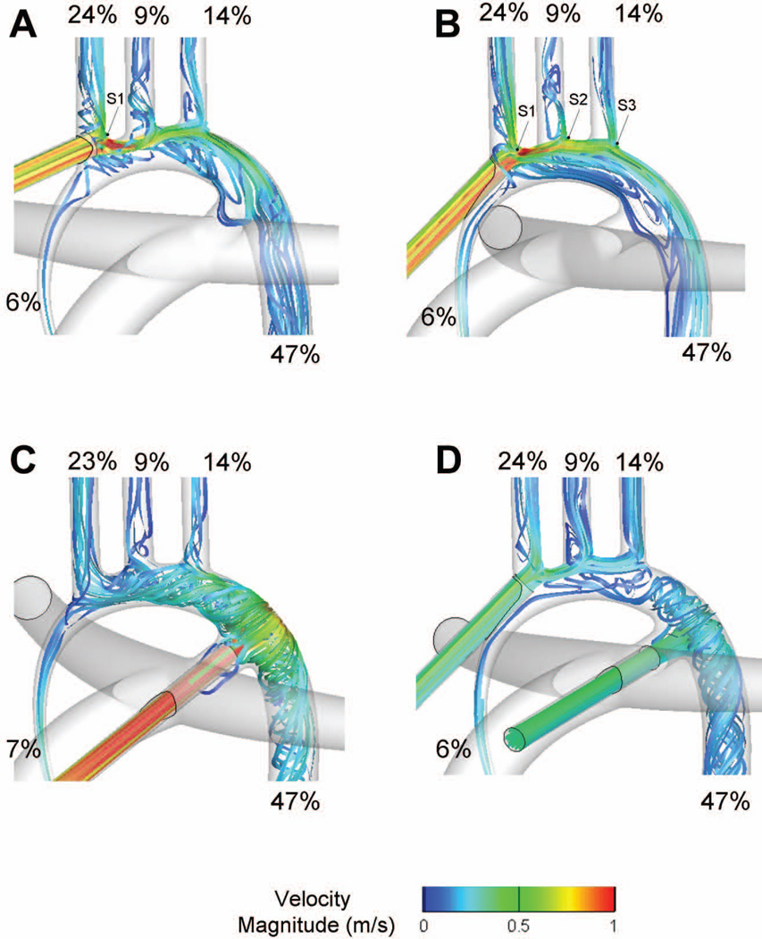 CANNULATION STRATEGY FOR AORTIC ARCH RECONSTRUCTION USING DEEP ...