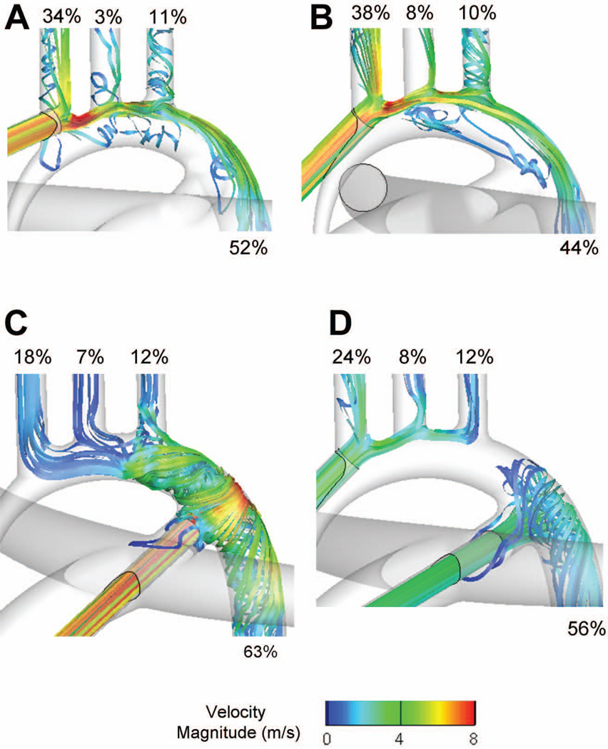 CANNULATION STRATEGY FOR AORTIC ARCH RECONSTRUCTION USING DEEP ...