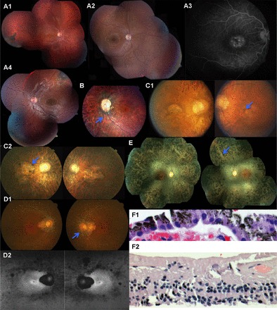 Fig. 4.