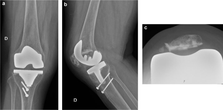 Figure 3