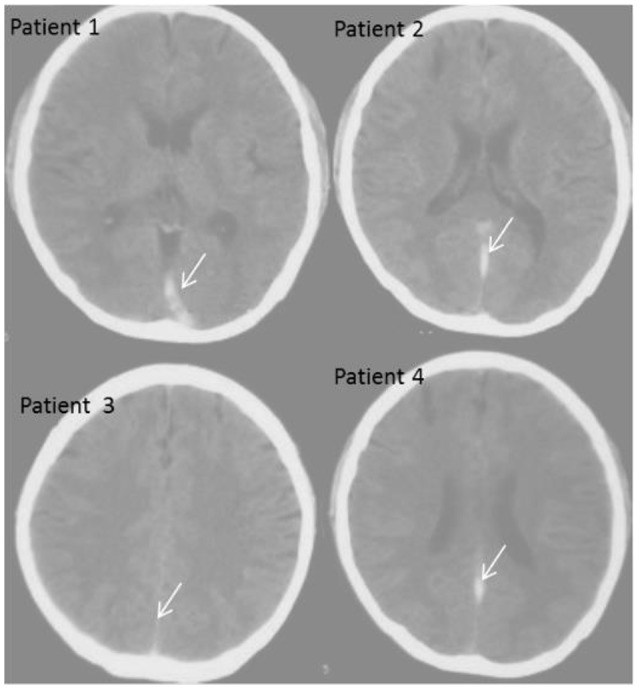 Figure 4