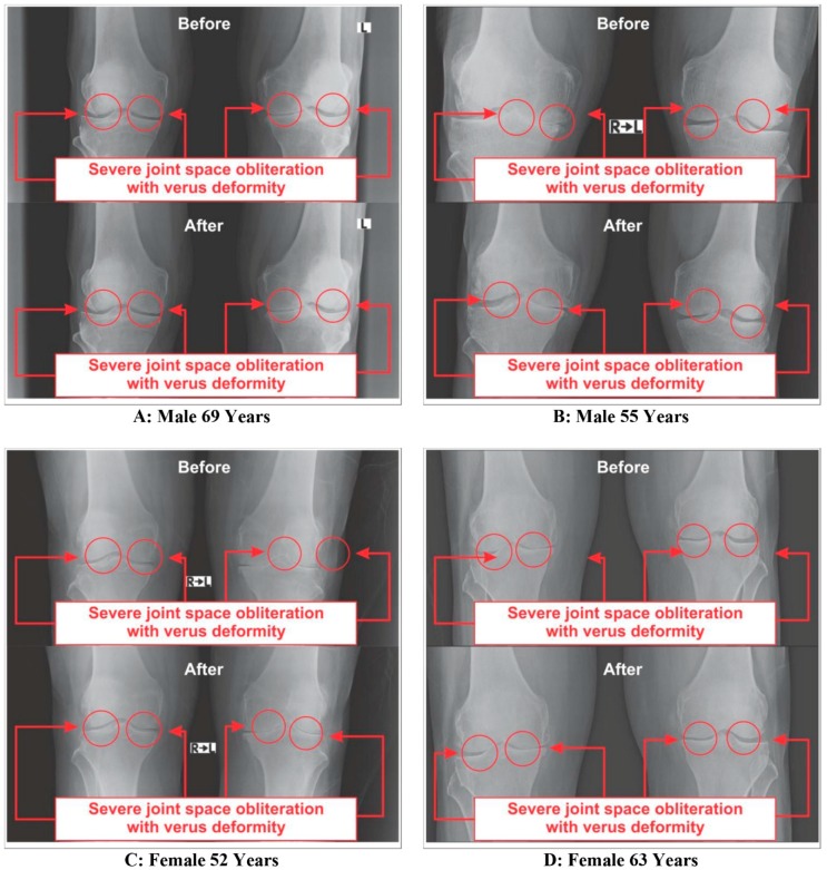 Figure 12