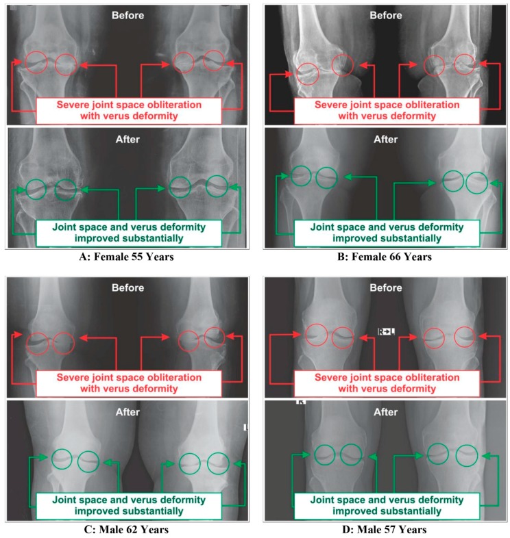 Figure 11