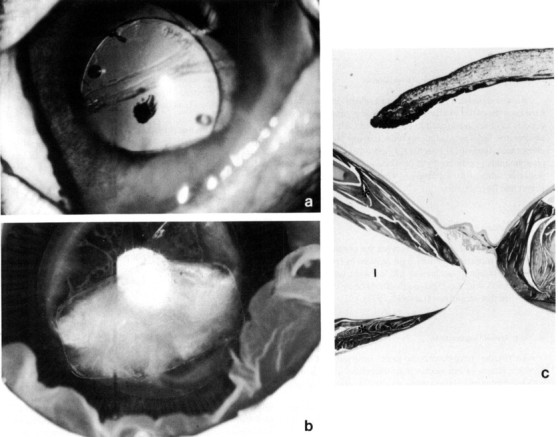 Fig. 12