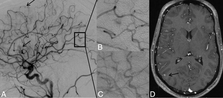 Fig 2.