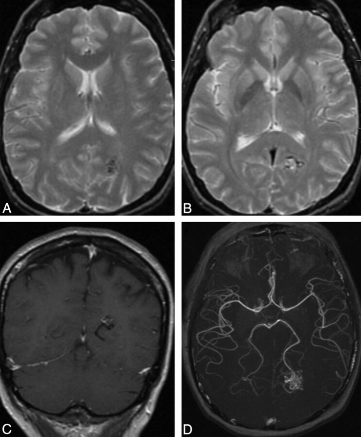 Fig 5.