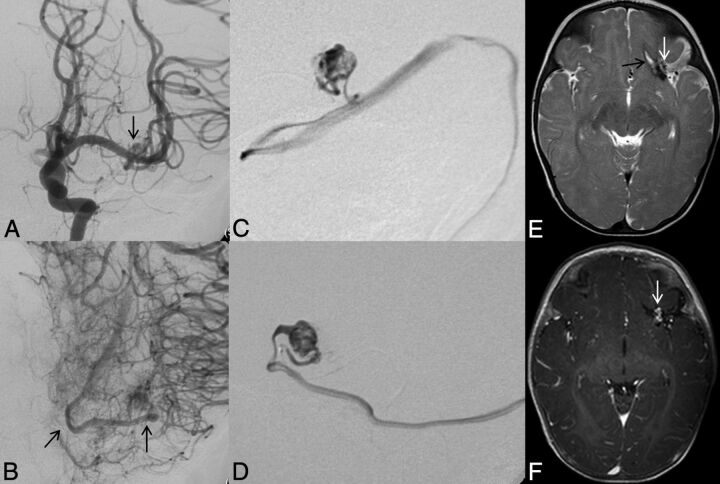 Fig 4.