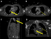 Fig 1