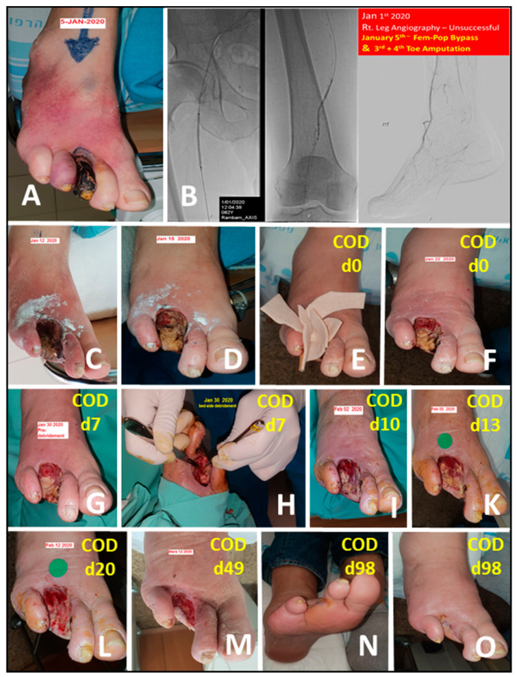 Figure 11