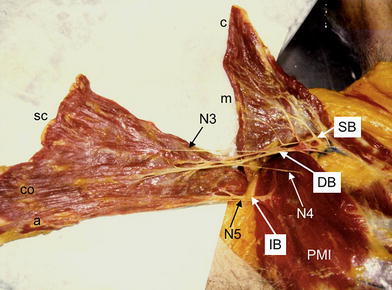 Fig. 11