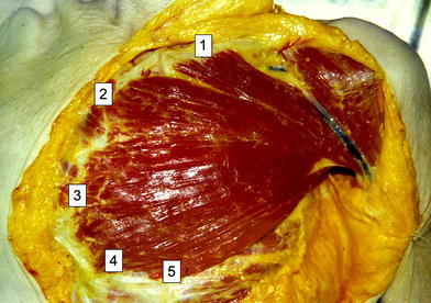 Fig. 5