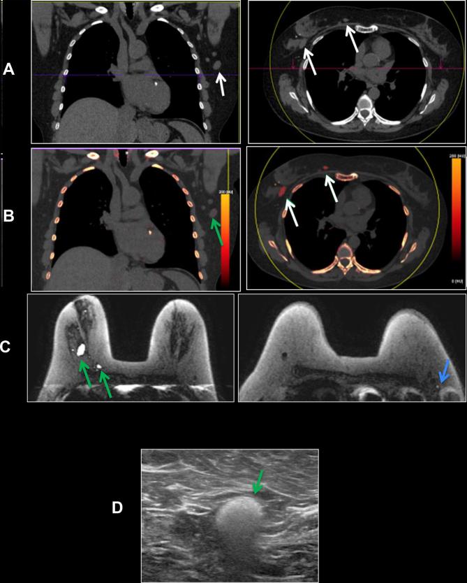 Figure 11. 