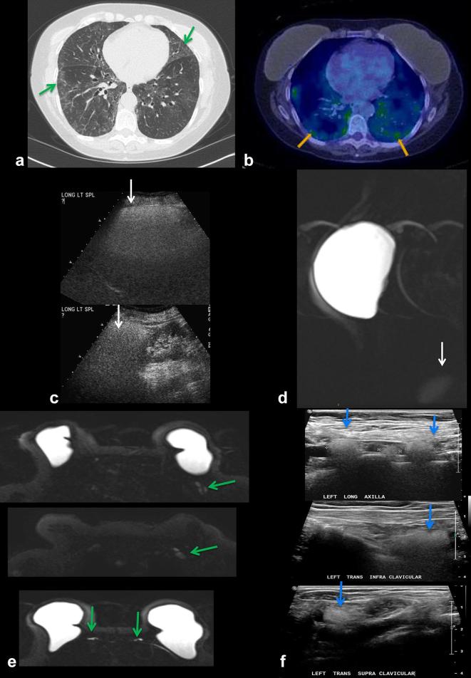 Figure 14. 