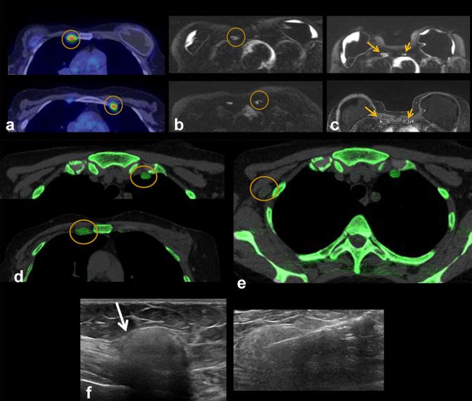 Figure 12. 