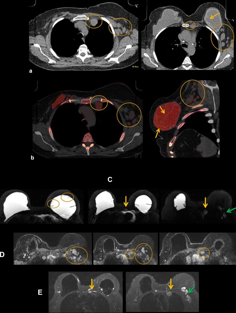 Figure 13. 