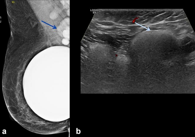 Figure 10. 