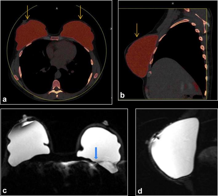 Figure 3. 