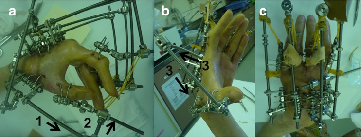 Fig. 2
