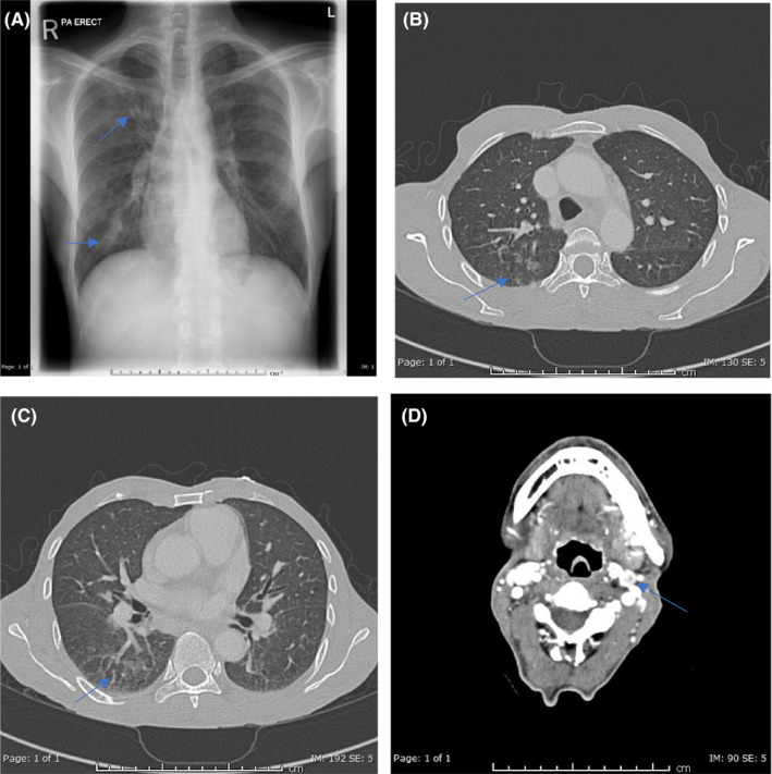 FIGURE 1