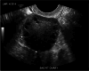 Fig. 5