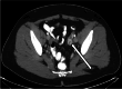 Fig. 11