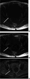 Fig. 12
