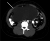 Fig. 14