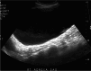 Fig. 13