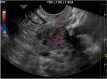 Fig. 10