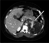 Fig. 4