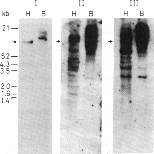 graphic file with name pnas00276-0052-a.jpg