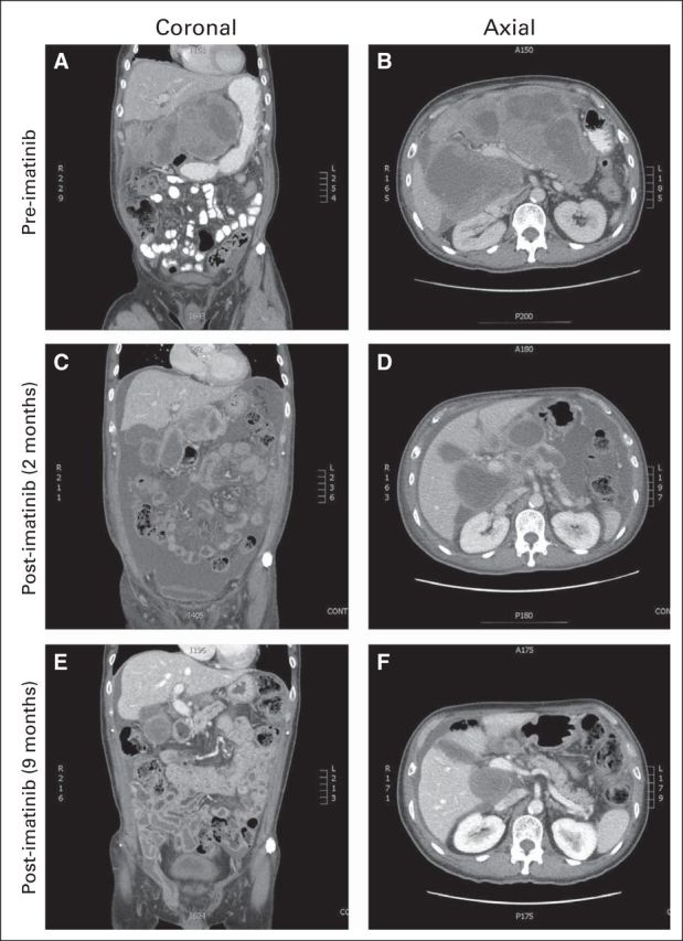 Fig 2.