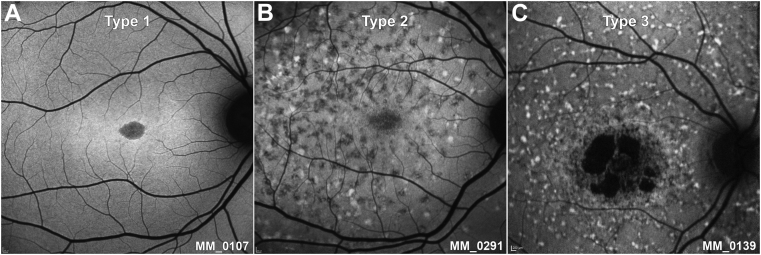 Figure 1