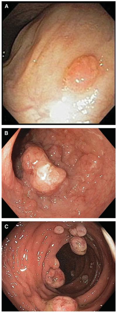 FIGURE 1