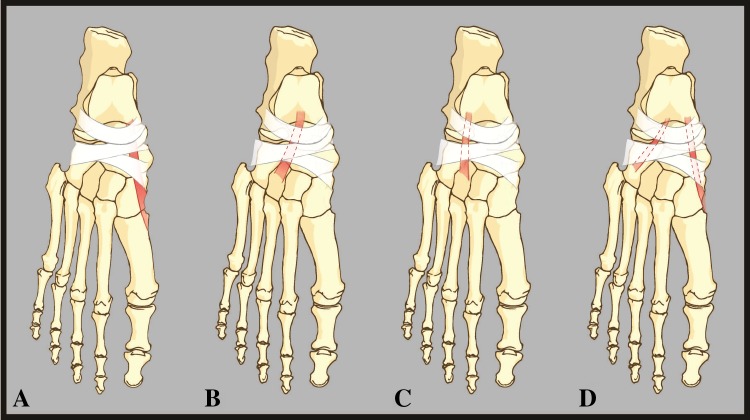 Fig. 1