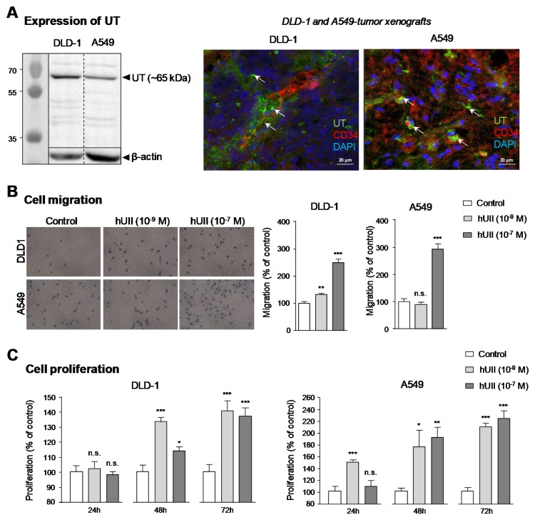 Development of Novel 111-In-Labelled DOTA Urotensin II Analogues for ...