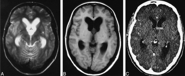 fig 2.