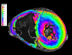 Mid-ventricular short-axis section of the ventricles in the control heart
shows the feasibility of myomapping the orientation of myocyte aggregates on
hierarchical phase-contrast tomography images at low spatial resolution. Myocyte
orientation was calculated by means of structure tensor analysis with an
in-house code based on the Python library structure-tensor (5,6). Colors
represent the helical angle of aggregates of myocytes, which show a gradual
transition in the thicker left ventricle from epicardium to
endocardium.