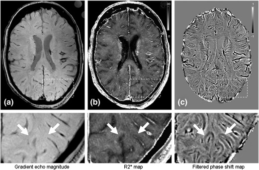 Fig. 2