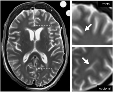 Fig. 6