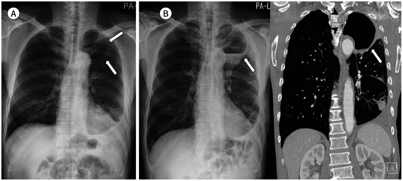 Fig. 11