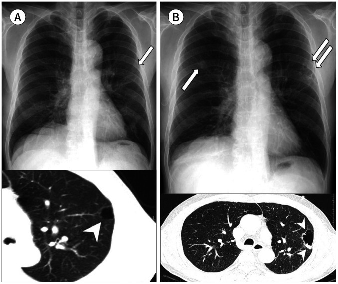 Fig. 10