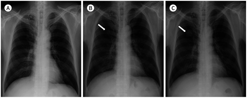 Fig. 15