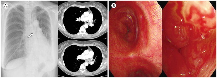 Fig. 14