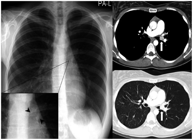 Fig. 13