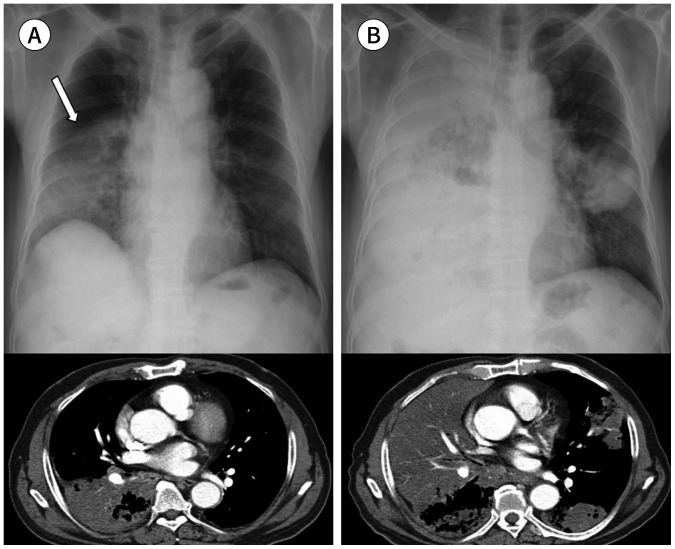 Fig. 12