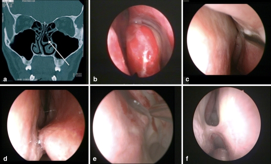 Fig. 1