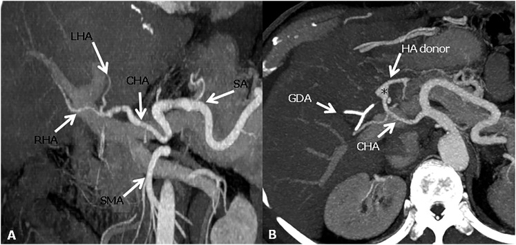 Figure 3.