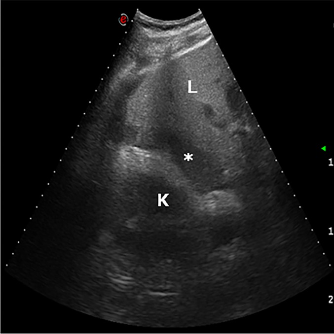 Figure 17.