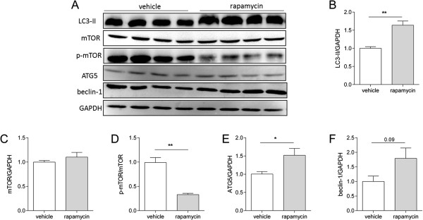 Rapamycin increases survival in ALS mice lacking mature lymphocytes - PMC